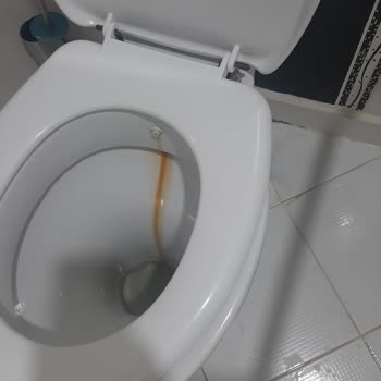 Özel Kemal Bayındır Hastanesi Gaziantep'te En Kötüsü