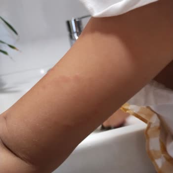 Yoyoland Çocuklara Değer Vermeyen Para Odaklı İhmalkar Bir Okul.