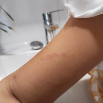 Yoyoland Çocuklara Değer Vermeyen Para Odaklı İhmalkar Bir Okul.