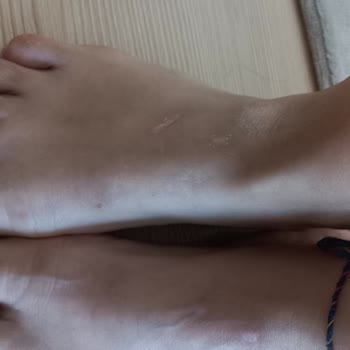 Deichmann Sandalet Yara Yaptı