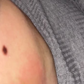 Elif Doğan (Samsun Clinic) Gittiğime Pişman Oldum