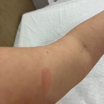 Elif Doğan (Samsun Clinic) Gittiğime Pişman Oldum