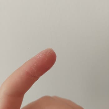 Vanish Kosla Migros Şikayet Parmaklarım Yandı