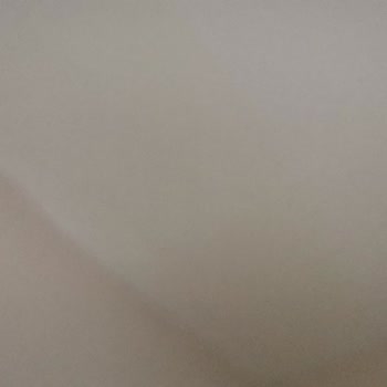 Kent Ekspertiz Sigorta Kabul Edilemez Bahanelerle Zararı Karşılamıyor.