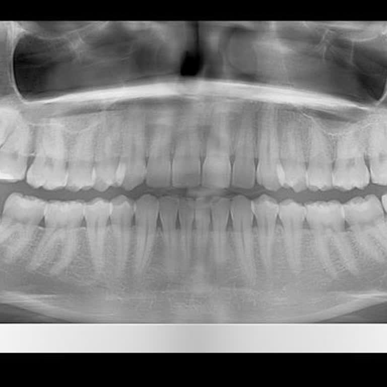 Bdd Boğaziçi Ağız Ve Diş Sağlığı Polikliniği Ücret İadesinde Yanlış Fatura Düzenlenmesi