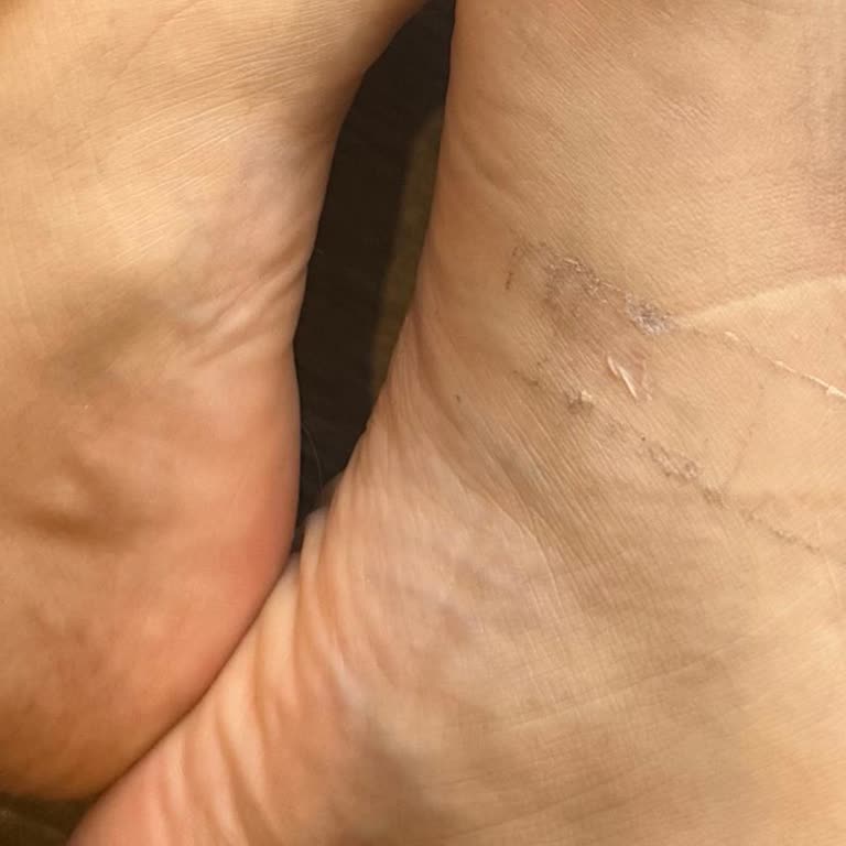 Guess İade 14 Gün Olmasına Rağmen Alınmadı