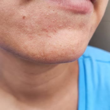 Loreal Paris L'Oreal Bright Reveal Güneş Kremi Cildimi Tahriş Etti