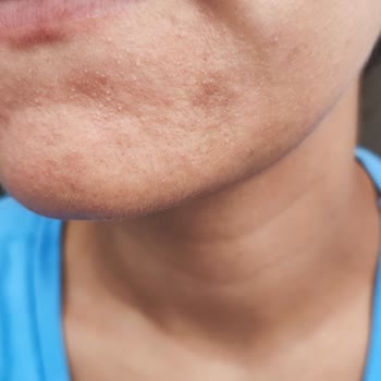 Loreal Paris L'Oreal Bright Reveal Güneş Kremi Cildimi Tahriş Etti