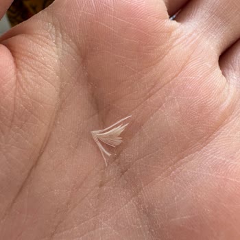 Namet Hindi Fümeden Tüy Çıktı