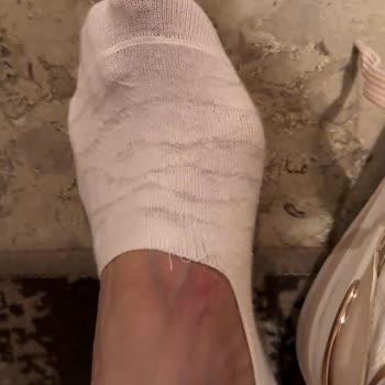 Aldo Shoes Kalitesiz Çanta Ve Ayakkabı Kusurlu İlk Gün Çantanın Askısı Kırıldı