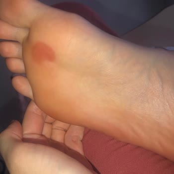 Derimod Terlik Ayağımı Yara Yaptı