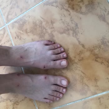 Derimod Terlik Ayağımı Yara Yaptı