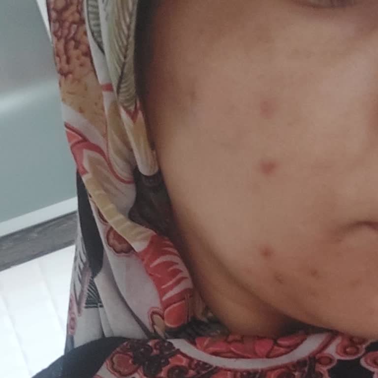 Aris Polikliniği Kayseri Güzellik Merkezi Deneyimi