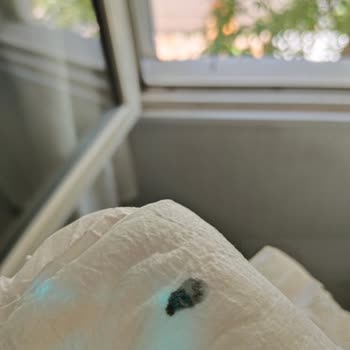 Goon Bebek Bezi Dayanıksız Bezler Ve Hijyen Sorunları