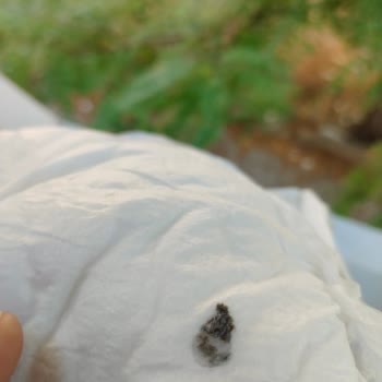 Goon Bebek Bezi Dayanıksız Bezler Ve Hijyen Sorunları