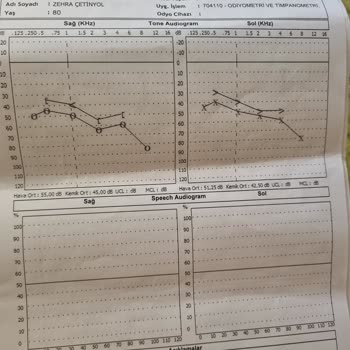 Özel Egepol Hastanesi Kontrol Muayenesi Ücret Alması