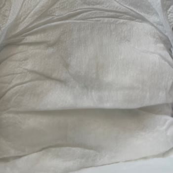 Sleepy Bebek Bezi İçinde Sürekli Tekrar Eden Yabancı Madde Çıkıyor.