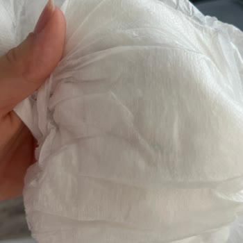 Sleepy Bebek Bezi İçinde Sürekli Tekrar Eden Yabancı Madde Çıkıyor.