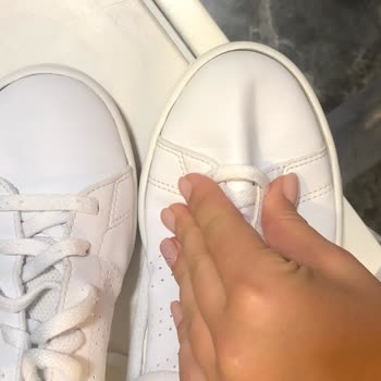 Adidas Ayakkabı Yırtılma Mağduriyeti