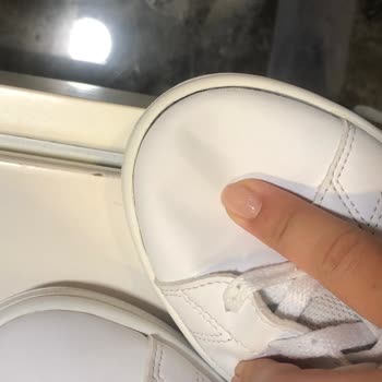 Adidas Ayakkabı Yırtılma Mağduriyeti