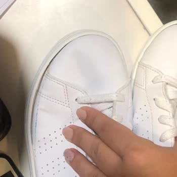 Adidas Ayakkabı Yırtılma Mağduriyeti