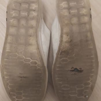 Guja Ayakkabılarında Kısa Sürede Deformasyon Ve İlgisizlik