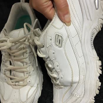 Skechers Ayakkabının Kısa Sürede Hasar Görmesi Ve Mağaza Deneyimi