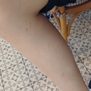 Monalisa Sağlıklı Güzellik Ücretimi Talep Ediyorum