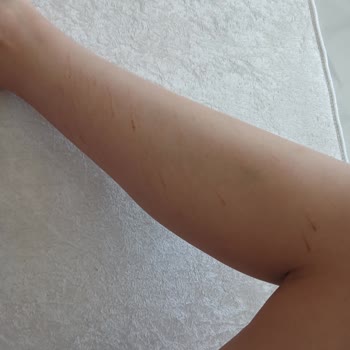 Monalisa Sağlıklı Güzellik Ücretimi Talep Ediyorum