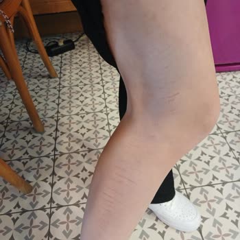 Monalisa Sağlıklı Güzellik Ücretimi Talep Ediyorum