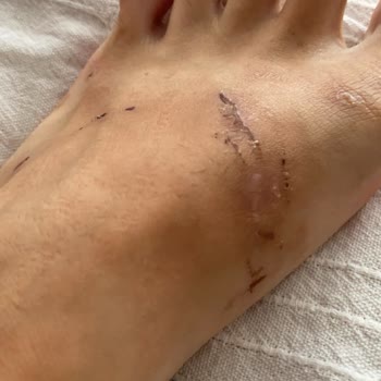 Nine West Terlik Ayağımı Yara Yaptı. Marka Hatası Olmadığını Savunuyor