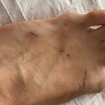 Nine West Terlik Ayağımı Yara Yaptı. Marka Hatası Olmadığını Savunuyor