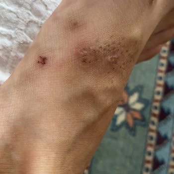 Nine West Terlik Ayağımı Yara Yaptı. Marka Hatası Olmadığını Savunuyor