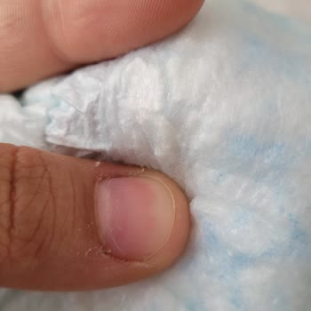 A101'den Aldığım Prima Bez Hatalı Çıktı Bebeğimin Sağlığı Tehlikede
