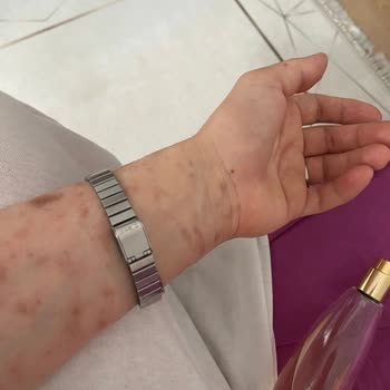 Avon Celebre Parfüm Alerji Sorunu