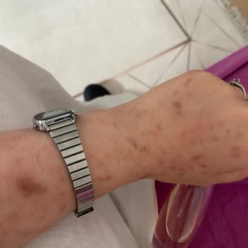 Avon Celebre Parfüm Alerji Sorunu