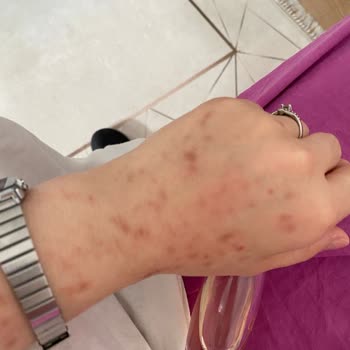 Avon Celebre Parfüm Alerji Sorunu