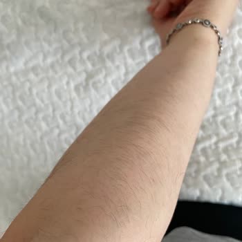 buzlazer.com Buzlazer İle Yüzümde Ve Vücudumda Eskisinden Daha Çok Tüy Çıktı.