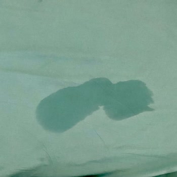 Prima Bebek Bezi Şikayet