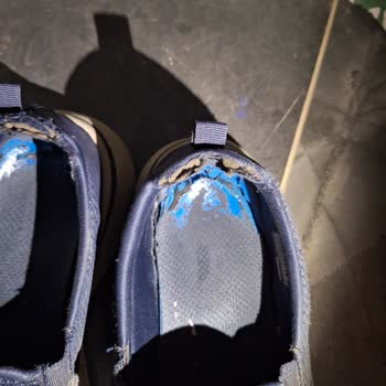 Skechers Aldığımız Ayakkabının Kısa Sürede Yıpranması Üzerine Şikayet