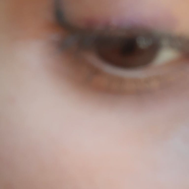 Meliderm Estetik Ve Güzellik Yanlış Eyeliner İşlemi!