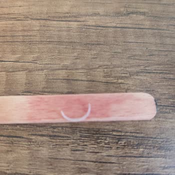 BİM Bugido Dondurmadan Tırnak Çıktı