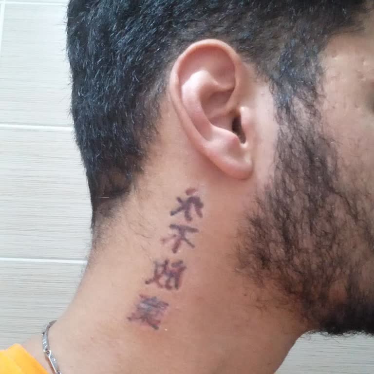 Leon Güzellik Merkezi (Sivas) Leon Dövme Silme Memnuniyetsizliği