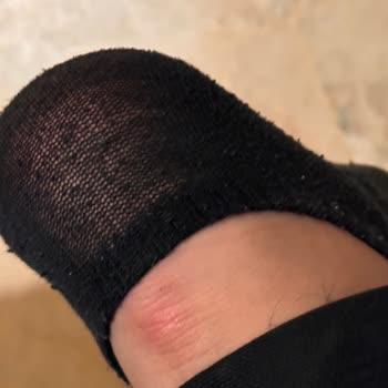 Skechers Hatalı Ürün Kabul Etmiyor