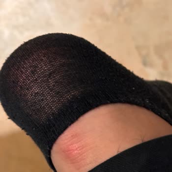 Skechers Hatalı Ürün Kabul Etmiyor