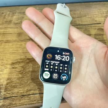 Apple Watch Se Sıcaktan Kolumu Yaktı