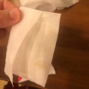 DeepFresh Sağlık Bakanlığından Haber Bekliyorum