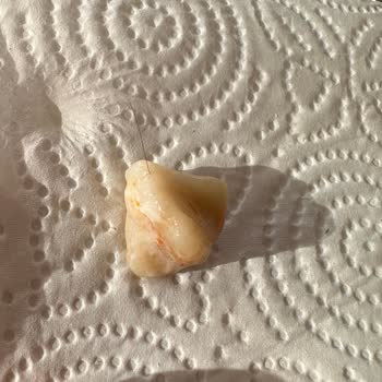 A101 Den Alınan Kaşıkla Mantıdan Kıl Çıktı