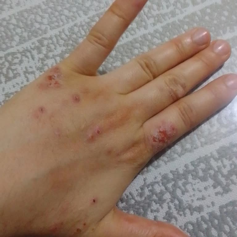 İrmet Hospital Sonuç Alamamak Ve Mağdur Olmak