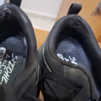 Skechers Kalitesiz Ayakkabı Deforme Oldu